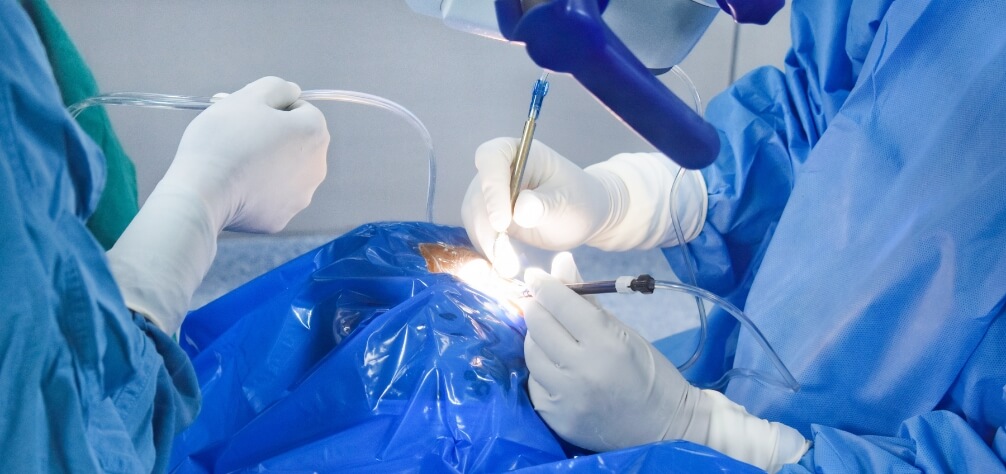 advanced retina treatment